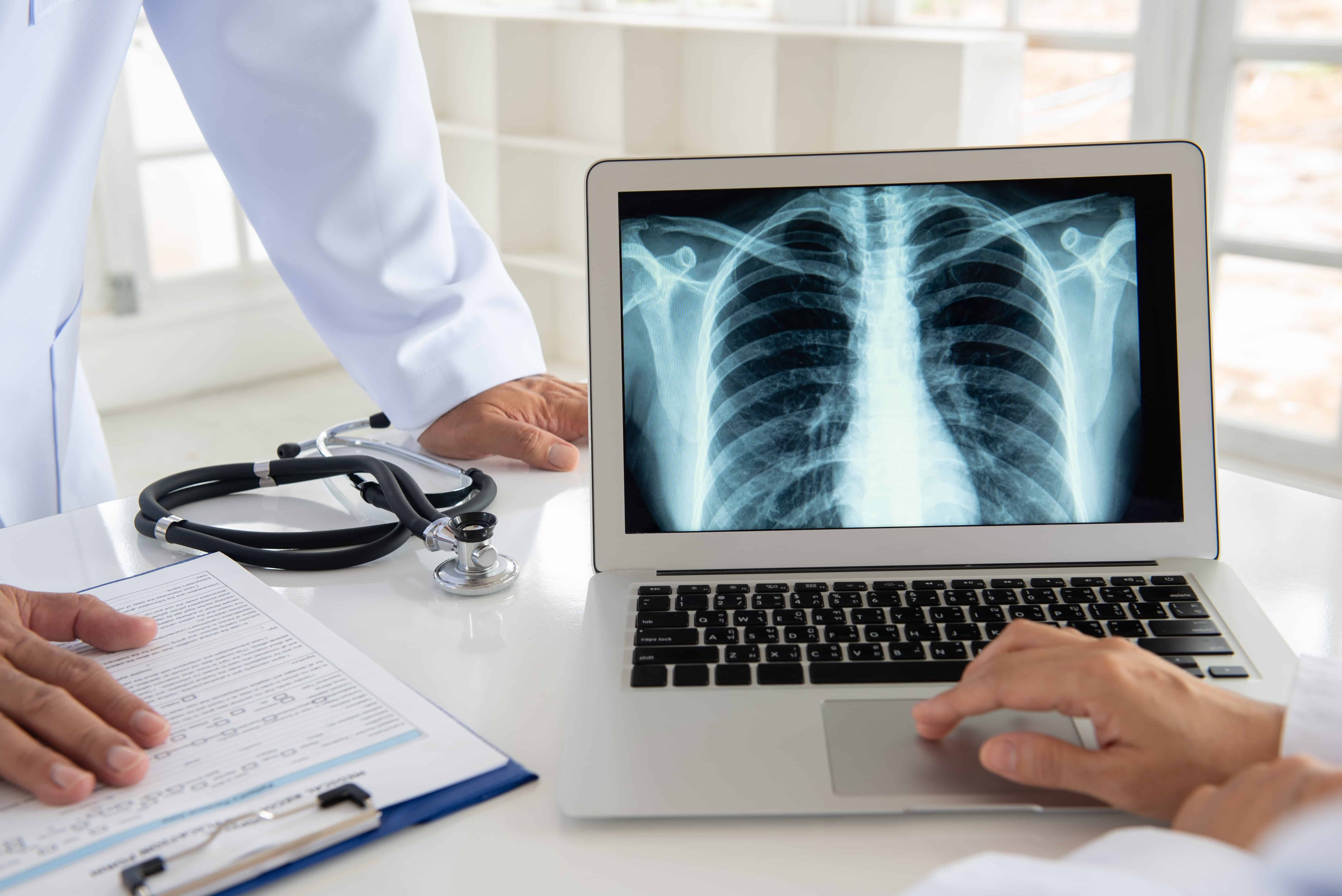 X-ray image of a lung