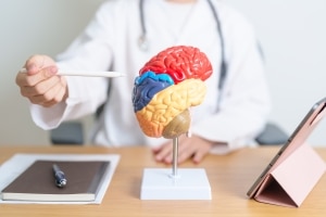 How to Treat Strokes
